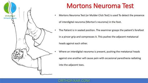 metatarsal compression test nerve|mulder's click test.